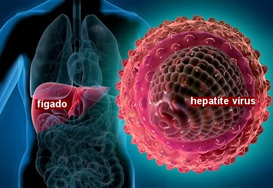 Figado-hepatite-virus